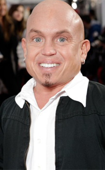 Martin Klebba